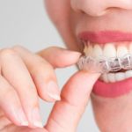 Invisalign 101 - What Every New Patient Needs to Know