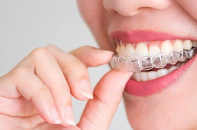 Invisalign 101 – What Every New Patient Needs to Know