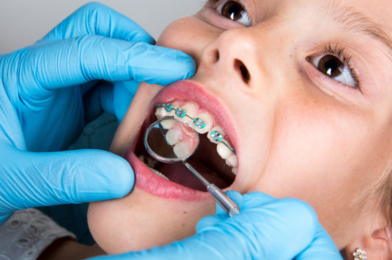 The Top 5 Benefits of Early Orthodontic Intervention for Children 